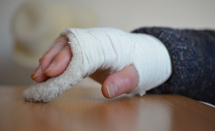 Hand Fractures Los Angeles